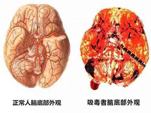 冰毒的危害是不可逆的吗