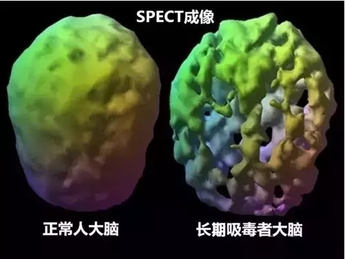 冰毒的危害比任何一种毒都可怕